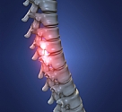 כירורגיית עמוד שדרה
